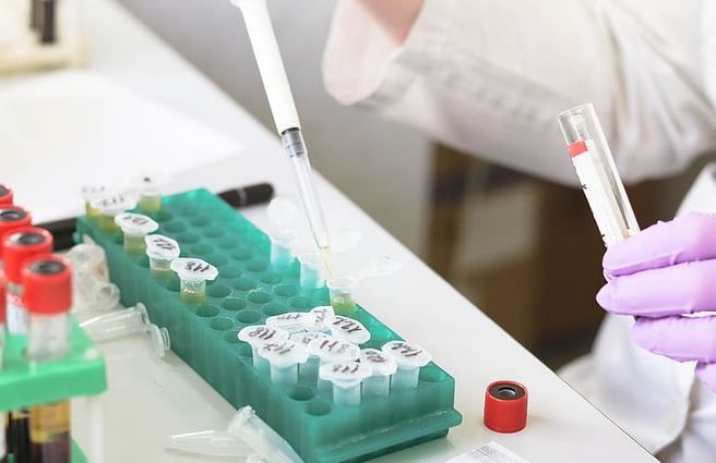 What is Impairment Testing for Goodwill